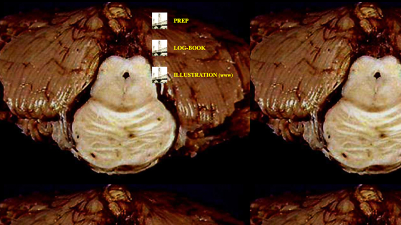 gallery image of Inside the Skull House: A Neuropoesis - Pons